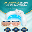 Hogar Dispositivo Laser para Hongos en las Uña de Tendeli- Ecuador en