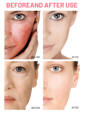 Piel radiante y sin edad: Serum de Rosas con Ácido Hialurónico - Multishop Chile E.I.R.L